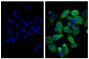 Human pancreatic carcinoma cell line MIA PaCa-2 was stained with Mouse Anti-Cytokeratin 18-UNLB (SB Cat. No. 10085-01; right) followed by Donkey Anti-Mouse IgG(H+L), Human SP ads-AF488 (SB Cat. No. 6410-30) and DAPI.