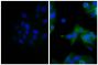 Human epithelial carcinoma cell line HEp-2 was stained with Mouse Anti-Human CD44-UNLB (SB Cat. No. 9400-01; right) followed by Goat Anti-Mouse IgG(H+L), Human ads-AF488 (SB Cat. No. 1031-30) and DAPI.