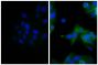 Human epithelial carcinoma cell line HEp-2 was stained with Mouse Anti-Human CD44-UNLB (SB Cat. No. 9400-01; right) followed by Goat Anti-Mouse IgG(H+L), Human ads-AF488 (SB Cat. No. 1031-30) and DAPI.