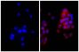 Human pancreatic carcinoma cell line MIA PaCa-2 was stained with Mouse Anti-Cytokeratin 18-UNLB (SB Cat. No. 10085-01; right) followed by Goat Anti-Mouse Kappa-TXRD (SB Cat. No. 1050-07) and DAPI.
