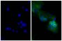 Human epithelial carcinoma cell line HEp-2 was stained with Mouse Anti-Human CD44-UNLB (SB Cat. No. 9400-01; right) followed by Goat Anti-Mouse Ig, Human ads-AF488 (SB Cat. No. 1010-30) and DAPI.