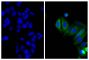 Human epithelial carcinoma cell line HEp-2 was stained with Mouse Anti-Cytokeratin 18-UNLB (SB Cat. No. 10085-01; right) followed by Goat Anti-Mouse IgG<sub>2b</sub>, Human/Bovine/Horse SP ads-BIOT (SB Cat. No. 1093-08), Streptavidin-CY2 (SB Cat. No. 7100-21), and DAPI.