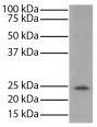 Mouse thymus tissue lysate was resolved by electrophoresis, transferred to PVDF membrane, and probed with Mouse Anti-Bcl-2-UNLB (SB Cat. No. 10065-01) followed by Goat Anti-Mouse IgG<sub>1</sub>, Human ads-HRP (SB Cat. No. 1070-05) and chemiluminescent detection.