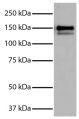 Purified Human Type I Collagen (SB Cat. No. 1200-01S) was resolved by electrophoresis, transferred to PVDF membrane, probed with Goat Anti-Type I Collagen-UNLB (SB Cat. No. 1310-01), and visualized using Donkey Anti-Goat IgG(H+L), Multi-Species SP ads-HRP (SB Cat. No. 6425-05) secondary antibody and chemiluminescent detection.