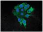 Human pancreatic carcinoma cell line MIA PaCa-2 was stained with Mouse Anti-Cytokeratin 8-FITC (SB Cat. No. 10080-02) followed by DAPI.