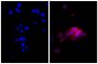 Human pancreatic carcinoma cell line MIA PaCa-2 was stained with Mouse Anti-Cytokeratin 18-UNLB (SB Cat. No. 10085-01; right) followed by Goat Anti-Mouse Kappa-AF555 (SB Cat. No. 1050-32) and DAPI.