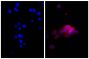 Human pancreatic carcinoma cell line MIA PaCa-2 was stained with Mouse Anti-Cytokeratin 18-UNLB (SB Cat. No. 10085-01; right) followed by Goat Anti-Mouse Kappa-AF555 (SB Cat. No. 1050-32) and DAPI.