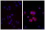 Human pancreatic carcinoma cell line MIA PaCa-2 was stained with Mouse Anti-Human CD44-UNLB (SB Cat. No. 9400-01; right) followed by Donkey Anti-Mouse IgG(H+L), Multi-Species SP ads-BIOT (SB Cat. No. 6415-08), Streptavidin-TXRD (SB Cat. No. 7100-07), and DAPI.