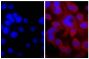 Human pancreatic carcinoma cell line MIA PaCa-2 was stained with Mouse Anti-Cytokeratin 18-UNLB (SB Cat. No. 10085-01; right) followed by Goat Anti-Mouse IgG(H+L), Rat ads-TRITC (SB Cat. No. 1034-03) and DAPI.