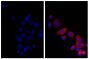 Human pancreatic carcinoma cell line MIA PaCa-2 was stained with Mouse Anti-Cytokeratin 18-UNLB (SB Cat. No. 10085-01; right) followed by Donkey Anti-Mouse IgG(H+L), Multi-Species SP ads-AF555 (SB Cat. No. 6415-32) and DAPI.