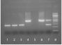 Lane 1 - E. coli Genomic DNA<br/>Lane 2 - Hybridoma Cell DNA<br/>Lane 3 - Negative Control (H<sup>2</sup>O)<br/>Lane 4 - Positive Control<br/>Lane 5 - Inhibited Sample<br/>Lane 6 - Strongly Contaminated <br/>Sample<br/>Lane 7 - Weakly Contaminated Sample<br/>Lane 8 - 100 bp DNA Ladder
