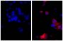 Human pancreatic carcinoma cell line MIA PaCa-2 was stained with Mouse Anti-Cytokeratin 18-UNLB (SB Cat. No. 10085-01; right) followed by Goat F(ab')<sub>2</sub> Anti-Mouse Ig, Human ads-AF555 (SB Cat. No. 1012-32) and DAPI.