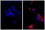 Human pancreatic carcinoma cell line MIA PaCa-2 was stained with Mouse Anti-Cytokeratin 18-UNLB (SB Cat. No. 10085-01; right) followed by Goat F(ab')<sub>2</sub> Anti-Mouse Ig, Human ads-AF555 (SB Cat. No. 1012-32) and DAPI.