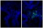 Paraffin embedded human gastric cancer tissue was stained with Rabbit IgG-UNLB isotype control (SB Cat. No. 0111-01; left) and Rabbit Anti-Human IgG(H+L), Mouse ads-UNLB (SB Cat. No. 6145-01; right) followed by Donkey Anti-Rabbit IgG(H+L), Mouse/Rat/Human SP ads-FITC (SB Cat. No. 6440-02) and DAPI.