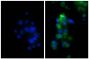 Human hepatocellular carcinoma cell line Hep G2 was stained with Rabbit IgG-UNLB isotype control (SB Cat. No. 0111-01; left) and Rabbit Anti-Human DR5-UNLB (SB Cat. No. 6600-01; right) followed by Donkey Anti-Rabbit IgG(H+L), Mouse/Rat/Human SP ads-FITC (SB Cat. No. 6440-02) and DAPI.