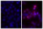 Human pancreatic carcinoma cell line MIA PaCa-2 was stained with Mouse Anti-Human CD44-BIOT (SB Cat. No. 9400-08; right) followed by Streptavidin-CY3 (SB Cat. No. 7100-12), DAPI, and mounted with Fluoromount-G<sup>®</sup> Anti-Fade (SB Cat. No. 0100-35).