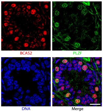 Paraffin embedded sections of mouse P8 testes were stained with anti-BCAS2 and anti-PLZF. The DNA was stained with Hoechst 33342 and mounted with Fluoromount-G<sup>&reg;</sup> (SB Cat. No. 0100-01).<br/>Images from Liu W, Wang F, Xu Q, Shi J, Zhang X, Liu X, et al. BCAS2 is involved in alternative mRNA splicing in spermatogonia and the transition to meiosis. Nat Commun. 2017;8:14182. Figure 1(d)<br/>Reproduced under the Creative Commons license https://creativecommons.org/licenses/by/4.0/