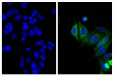 Human epithelial carcinoma cell line HEp-2 was stained with Mouse Anti-Cytokeratin 18-UNLB (SB Cat. No. 10085-01; right) followed by Goat Anti-Mouse IgG<sub>2b</sub>, Human/Bovine/Horse SP ads-BIOT (SB Cat. No. 1093-08), Streptavidin-CY2 (SB Cat. No. 7100-21), and DAPI.