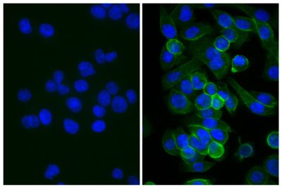 Human pancreatic carcinoma cell line MIA PaCa-2 was stained with Mouse Anti-Human CD44-UNLB (SB Cat. No. 9400-01; right) followed by Rabbit Anti-Mouse IgG(H+L), Human ads-BIOT (SB Cat. No. 6175-08), Streptavidin-FITC (SB Cat. No. 7100-02), and DAPI.