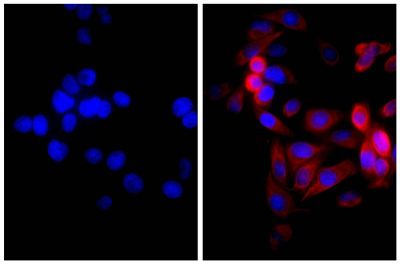 Human pancreatic carcinoma cell line MIA PaCa-2 was stained with Mouse Anti-Cytokeratin 18-UNLB (SB Cat. No. 10085-01; right) followed by Goat Anti-Mouse IgG(H+L), Rat ads-AF555 (SB Cat. No. 1034-32) and DAPI.