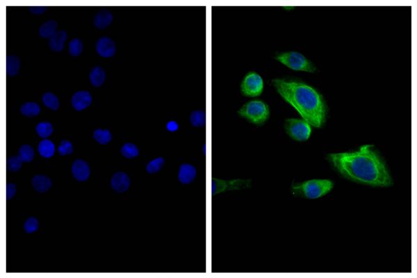 Human pancreatic carcinoma cell line MIA PaCa-2 was stained with Mouse Anti-Cytokeratin 18-UNLB (SB Cat. No. 10085-01; right) followed by Goat F(ab')<sub>2</sub> Anti-Mouse IgG<sub>2b</sub>, Human ads-FITC (SB Cat. No. 1092-02) and DAPI.