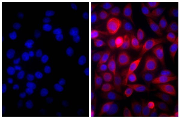 Human pancreatic carcinoma cell line MIA PaCa-2 was blocked with 10% Normal Goat Serum (SB Cat. No. 0060-01) and stained with Mouse Anti-Cytokeratin 18-UNLB (SB Cat. No. 10085-01; right) followed by Goat Anti-Mouse IgG(H+L), Human ads-AF555 (SB Cat. No. 1031-32) and DAPI.