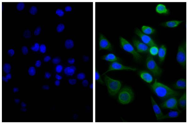 Human pancreatic carcinoma cell line MIA PaCa-2 was stained with Mouse Anti-Cytokeratin 18-UNLB (SB Cat. No. 10085-01; right) followed by Goat Anti-Mouse IgG(H+L), Human/Bovine/Horse SP ads-BIOT (SB Cat. No. 1037-08), Streptavidin-FITC (SB Cat. No. 7100-02), and DAPI.