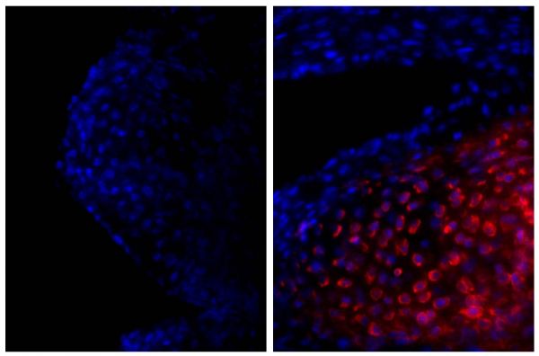 Frozen newborn mouse cartilage section was stained with Goat Anti-Type II Collagen-UNLB (SB Cat. No. 1320-01; right) followed by Donkey Anti-Goat IgG(H+L), Mouse/Rat SP ads-AF555 (SB Cat. No. 6420-32) and DAPI.