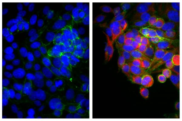 Human epithelial carcinoma cell line HEp-2 was stained with Mouse Anti-Cytokeratin 18-UNLB (SB Cat. No. 10085-01; right) and Mouse Anti-Human CD44-FITC (SB Cat. No. 9400-02) followed by Goat F(ab')<sub>2</sub> Anti-Mouse IgG<sub>2b</sub>, Human ads-BIOT (SB Cat. No. 1092-08), Streptavidin-CY3 (SB Cat. No. 7100-12), and DAPI.