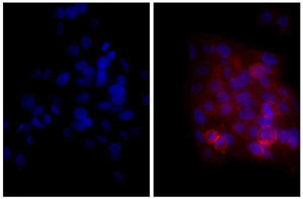 Human epithelial carcinoma cell line HEp-2 was stained with Mouse Anti-Human CD44-UNLB (SB Cat. No. 9400-01; right) followed by Goat Anti-Mouse Ig, Human ads-TXRD (SB Cat. No. 1010-07) and DAPI.