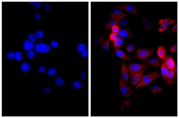 Human pancreatic carcinoma cell line MIA PaCa-2 was stained with Mouse Anti-Cytokeratin 18-UNLB (SB Cat. No. 10085-01; right) followed by Goat Anti-Mouse IgG(H+L), Rat ads-AF555 (SB Cat. No. 1034-32) and DAPI.