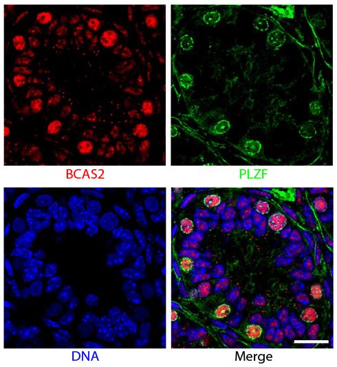 Paraffin embedded sections of mouse P8 testes were stained with anti-BCAS2 and anti-PLZF. The DNA was stained with Hoechst 33342 and mounted with Fluoromount-G<sup>®</sup> (SB Cat. No. 0100-01).<br/>Images from Liu W, Wang F, Xu Q, Shi J, Zhang X, Liu X, et al. BCAS2 is involved in alternative mRNA splicing in spermatogonia and the transition to meiosis. Nat Commun. 2017;8:14182. Figure 1(d)<br/>Reproduced under the Creative Commons license https://creativecommons.org/licenses/by/4.0/