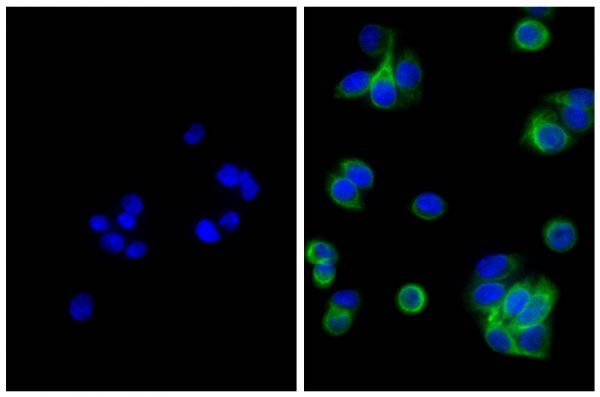 Human pancreatic carcinoma cell line MIA PaCa-2 was stained with Mouse Anti-Cytokeratin 18-UNLB (SB Cat. No. 10085-01; right) followed by Goat Anti-Mouse IgG(H+L), Multi-Species SP ads-FITC (SB Cat. No. 1038-02) and DAPI.