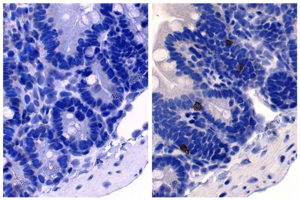 Paraffin embedded mouse small intestine section was stained with Rat Anti-Mouse IgE-UNLB (SB Cat. No. 1130-01; right) followed by an HRP conjugated secondary antibody, DAB, and hematoxylin.
