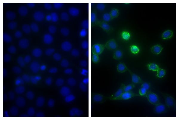 Human pancreatic carcinoma cell line MIA PaCa-2 was stained with Mouse Anti-Human CD44-BIOT (SB Cat. No. 9400-08; right) followed by Streptavidin-FITC (SB Cat. No. 7100-02), DAPI, and mounted with Fluoromount-G<sup>®</sup> Anti-Fade (SB Cat. No. 0100-35).