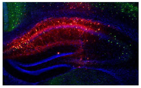 Frozen section of Pvalb-IRES-CRE mouse CA1 hippocampus injected with AAV-hM4Di-mCherry was stained with anti-parvalbumin followed by a secondary antibody and mounted with DAPI Fluoromount-G<sup>®</sup> (SB Cat. No. 0100-20).<br/>Image from Ognjanovski N, Schaeffer S, Wu J, Mofakham S, Maruyama D, Zochowski M, et al. Parvalbumin-expressing interneurons coordinate hippocampal network dynamics required for memory consolidation. Nat Commun. 2017;8:15039. Figure 2(a)<br/>Reproduced under the Creative Commons license https://creativecommons.org/licenses/by/4.0/