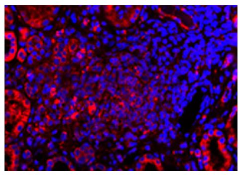 Paraffin embedded human kidney section from AAV patient was stained with anti-C5L2 followed by Goat Anti-Rabbit IgG(H+L), Mouse/Human ads-TRITC (SB Cat. No. 4050-03) and DAPI.<br/>Image from Yuan J, Gou S, Huang J, Hao J, Chen M, Zhao M. C5a and its receptors in human anti-neutrophil cytoplasmic antibody (ANCA)-associated vasculitis. Arthritis Res Ther. 2012;14:R140. Figure 3(c)<br/>Reproduced under the Creative Commons license https://creativecommons.org/licenses/by/2.0/