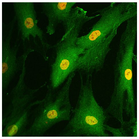 Human fibroblast-like synoviocytes were stained with anti-RelA followed by Goat Anti-Rabbit IgG(H+L), Mouse/Human ads-FITC (SB Cat. No. 4050-02) and DAPI.<br/>Image from Crowley T, O'Neil JD, Adams H, Thomas AM, Filer A, Buckley CD, et al. Priming in response to pro-inflammatory cytokines is a feature of adult synovial but not dermal fibroblasts. Arthritis Res Ther. 2017;19:35. Figure S1<br/>Reproduced under the Creative Commons license https://creativecommons.org/licenses/by/4.0/