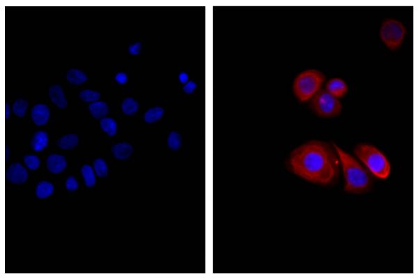 Human pancreatic carcinoma cell line MIA PaCa-2 was stained with Mouse Anti-Cytokeratin 18-UNLB (SB Cat. No. 10085-01; right) followed by Donkey Anti-Mouse IgG(H+L), Human SP ads-AF555 (SB Cat. No. 6410-32) and DAPI.