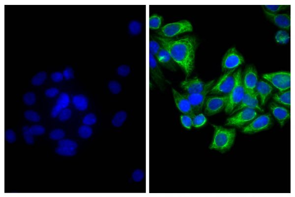 Human epithelial carcinoma cell line HEp-2 was stained with Mouse Anti-Cytokeratin 18-UNLB (SB Cat. No. 10085-01; right) followed by Goat Anti-Mouse IgG<sub>2b</sub>, Human/Bovine/Horse SP ads-FITC (SB Cat. No. 1093-02) and DAPI.