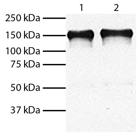 Total cell lysates from HEp-2 (Lane 1) and MIA PaCa-2 (Lane 2) cells were resolved by electrophoresis, transferred to PVDF membrane, and probed with Mouse Anti-Human EGFR-UNLB (SB Cat. No. 10400-01).  Proteins were visualized using Goat Anti-Mouse IgG, Human ads-HRP (SB Cat. No. 1030-05) secondary antibody and chemiluminescent detection.