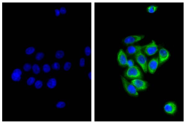 Human pancreatic carcinoma cell line MIA PaCa-2 was stained with Mouse Anti-Cytokeratin 18-UNLB (SB Cat. No. 10085-01; right) followed by Donkey Anti-Mouse IgG(H+L), Multi-Species SP ads-AF488 (SB Cat. No. 6415-30) and DAPI.