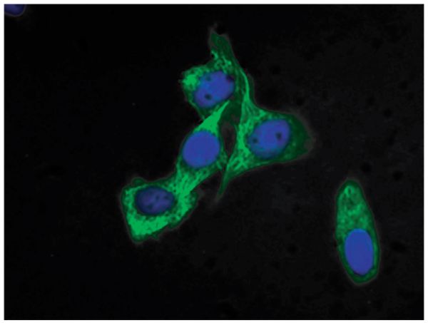 Human mammary gland carcinoma cell line HCC38 was stained with Mouse Anti-Cytokeratin 18-FITC (SB Cat. No. 10085-02) followed by DAPI.