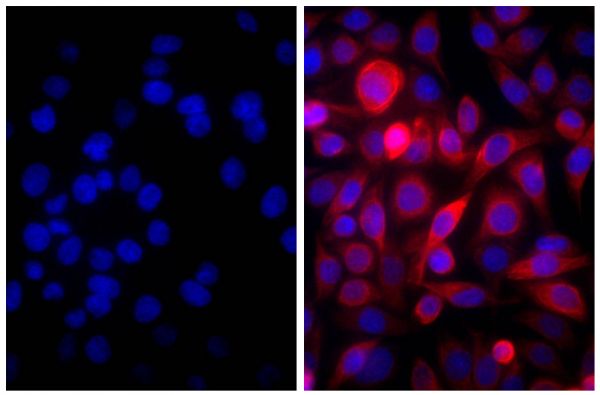 Human pancreatic carcinoma cell line MIA PaCa-2 was stained with Mouse Anti-Cytokeratin 18-UNLB (SB Cat. No. 10085-01; right) followed by Goat Anti-Mouse IgG(H+L), Human ads-AF555 (SB Cat. No. 1031-32) and DAPI.