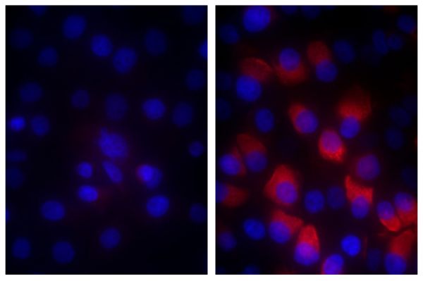 Human pancreatic carcinoma cell line MIA PaCa-2 was stained with Mouse IgG<sub>1</sub>-BIOT (SB Cat. No. 0102-08; left) and Mouse Anti-Fibrillin-1-BIOT (SB Cat. No. 1405-08; right) followed by Streptavidin-CY3.5 (SB Cat. No. 7100-24) and DAPI.