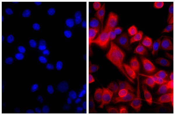 Human pancreatic carcinoma cell line MIA PaCa-2 was stained with Mouse Anti-Cytokeratin 18-UNLB (SB Cat. No. 10085-01; right) followed by Goat F(ab')<sub>2</sub> Anti-Mouse IgG(H+L), Human ads-AF555 (SB Cat. No. 1032-32) and DAPI.