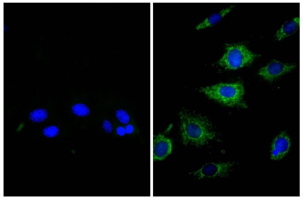 NIH/Swiss mouse fibroblast cell line 3T3 was stained with Rat Anti-β-Actin-UNLB (right) followed by Donkey Anti-Rat IgG(H+L), Mouse SP ads-BIOT (SB Cat. No. 6430-08), Streptavidin-FITC (SB Cat. No. 7100-02), and DAPI.