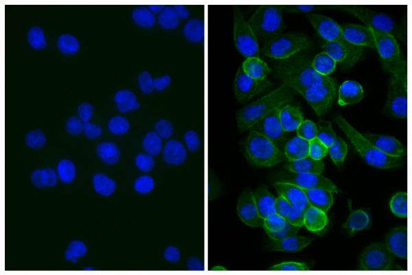 Human pancreatic carcinoma cell line MIA PaCa-2 was stained with Mouse Anti-Human CD44-UNLB (SB Cat. No. 9400-01; right) followed by Rabbit Anti-Mouse IgG(H+L), Human ads-BIOT (SB Cat. No. 6175-08), Streptavidin-FITC (SB Cat. No. 7100-02), and DAPI.