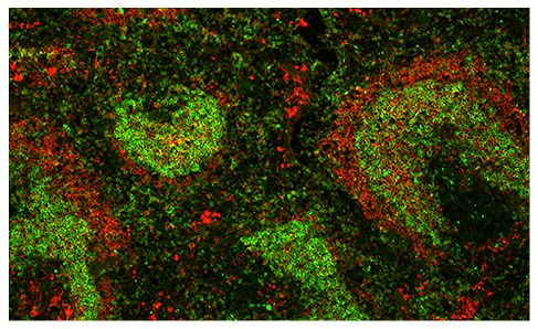 Frozen mouse spleen tissue was stained with Goat Anti-Mouse IgM, Human ads-TXRD (SB Cat. No. 1020-07) and Rat Anti-Mouse IgD-BIOT (SB Cat. No. 1120-08) followed by Streptavidin-AF488.<br/>Image from Ren W, Lagerstedt K, Grimsholm O, Stern A, Sun J, Fang Y, et al. Uncoupling of natural IgE production and CD23 surface expression levels. PLoS One. 2013;8(4):e62851. Figure 2(c)<br/>Reproduced under the Creative Commons Attribution License