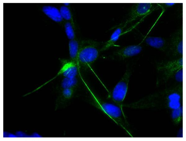 Human astrocytoma cell line CCF-STTG1 was stained with Mouse Anti-Human GFAP-UNLB (SB Cat. No. 12075-01) followed by Rabbit Anti-Mouse IgG(H+L), Human ads-FITC (SB Cat. No. 6175-02) and DAPI.